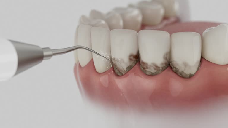 Trusted Dental Implants service in Stedman, NC - Dentist Open Now